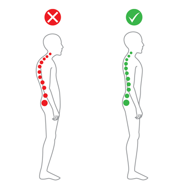 anatomic representation of a painful spine and a normal spine